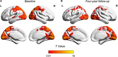 Longitudinal Changes in Whole-Brain Functional Connectivity Strength Patterns and the Relationship With the Global Cognitive Decline in Older Adults